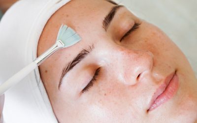 Revitalize Your Skin: Unveiling the World of Chemical Peels for HEALTH AND SKINCARE / SOMATOLOGY