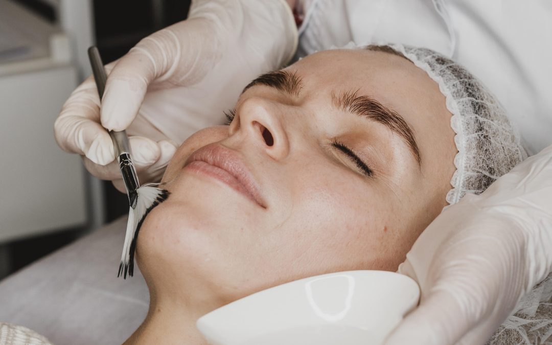 The Marvels of Glycolic Acid Peels in HEALTH AND SKINCARE / SOMATOLOGY
