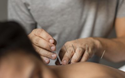 Acupuncture and HEALTH AND SKINCARE / SOMATOLOGY: Navigating the Meridians of Holistic Wellness